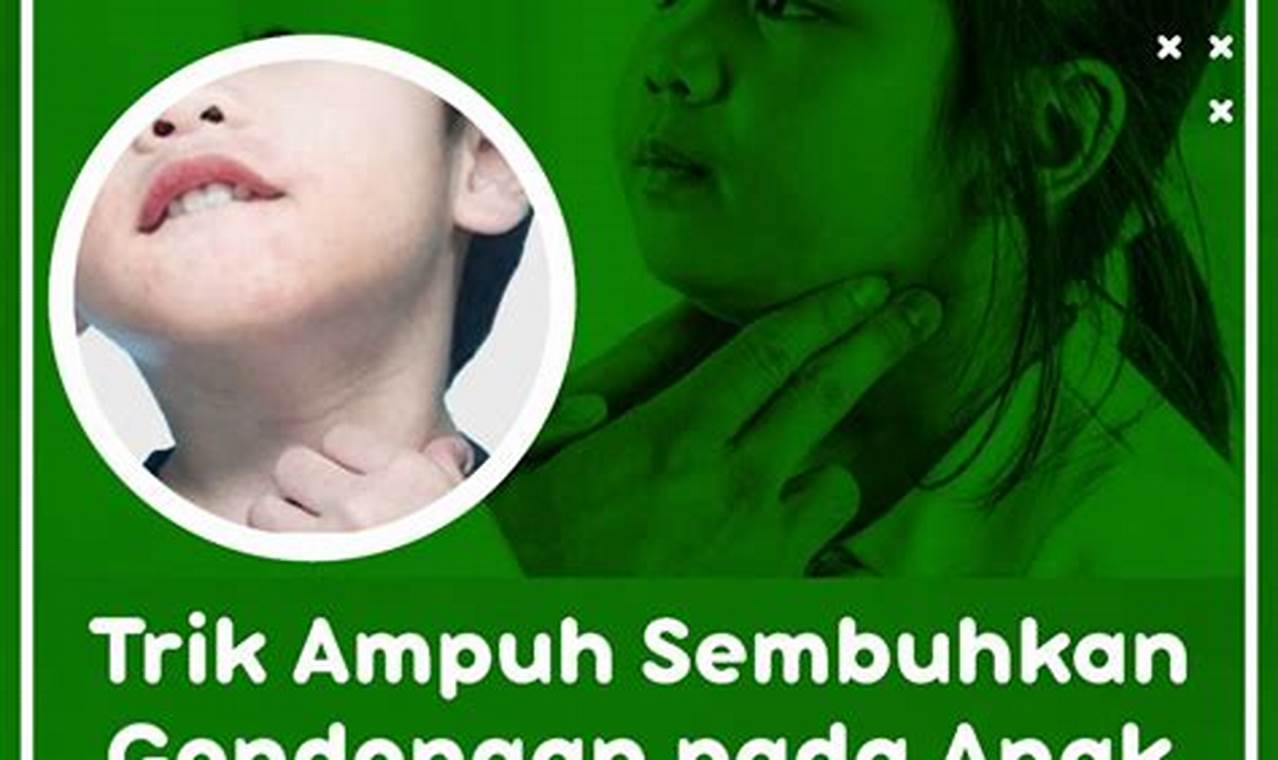 Cara Mengatasi Gondongan